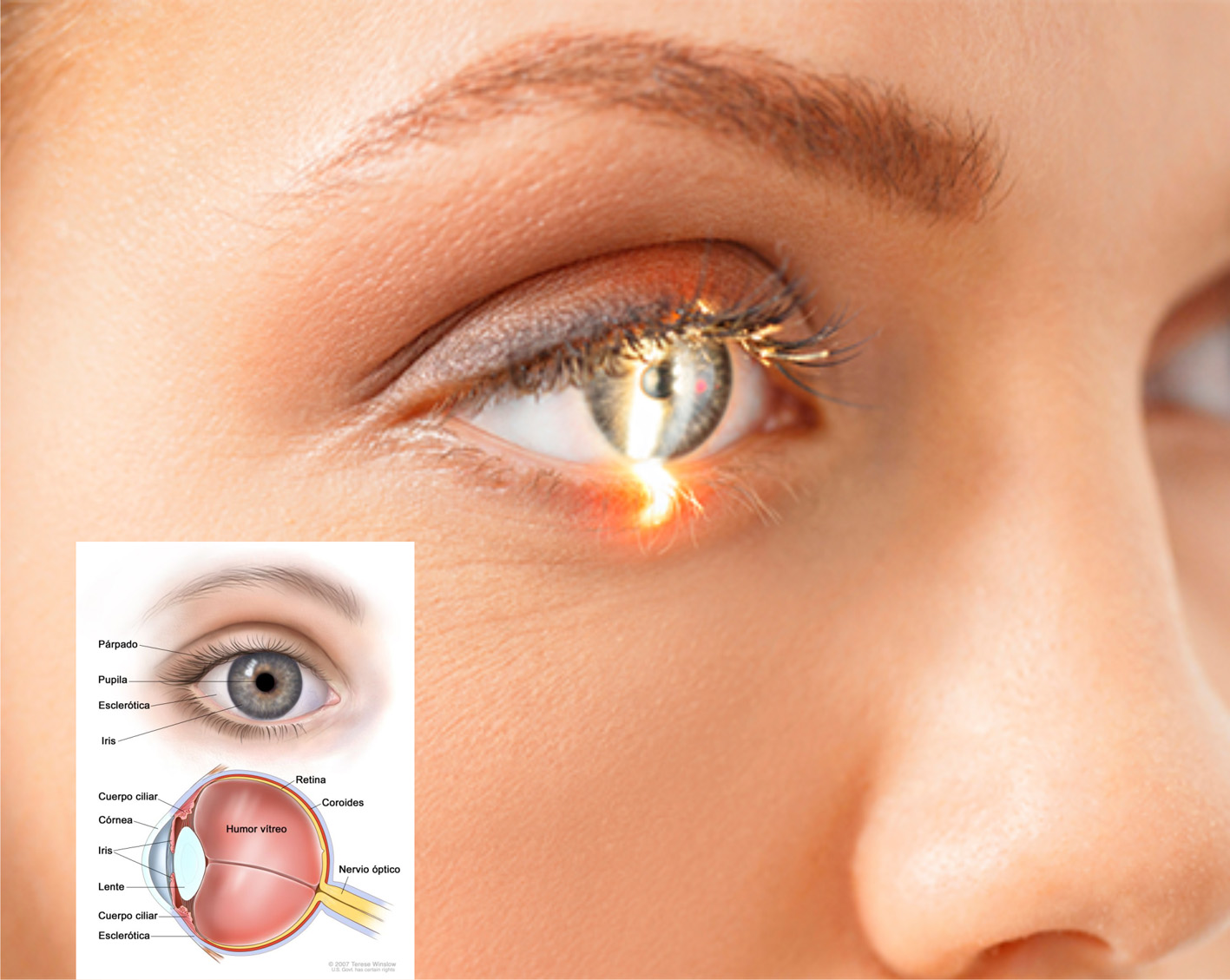 imagen-ojo